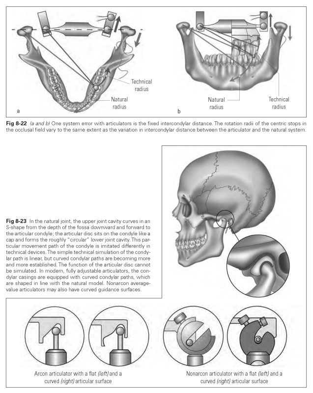 Articulatia temporo mandibulara - dr. aristide - dentist bun in Bucuresti