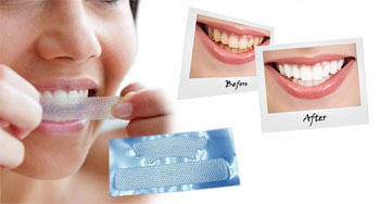 Teeth whitening tips at home