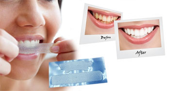 teeth whitening tips and tricks