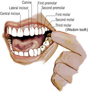 Tooth cavity remineralization