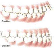 Normal occlusion of teeth ppt
