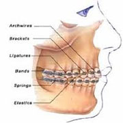 Orthodontic therapy jobs