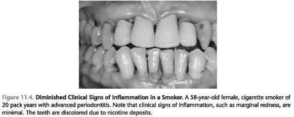 influence on the immune response