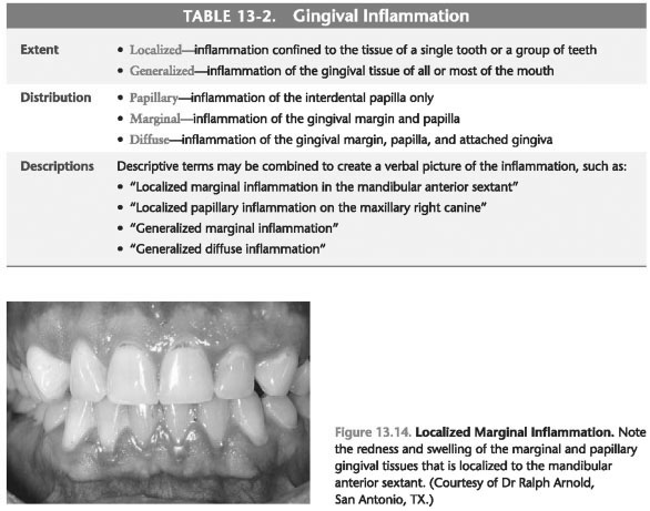 Gingival inflammation index