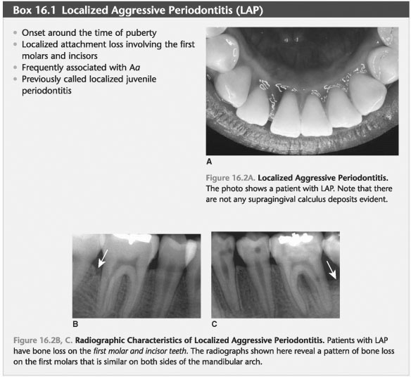 Localized aggressive periodontitis neutrophil