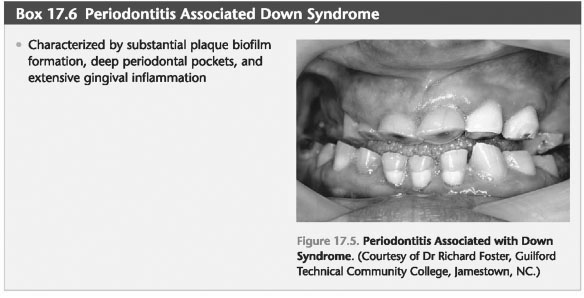 Genetic disorder fabry disease