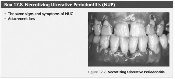 Necrotizing periodontal diseases pdf