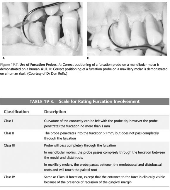 Furcation involvement prognosis