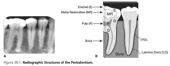 Radiographic Appearance of the Periodontium