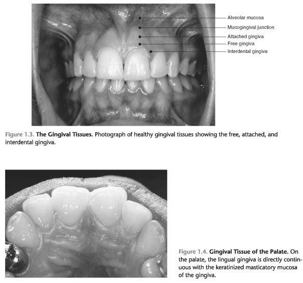 Boundaries of the gingival sulcus