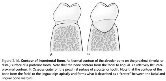 Bone defects at birth