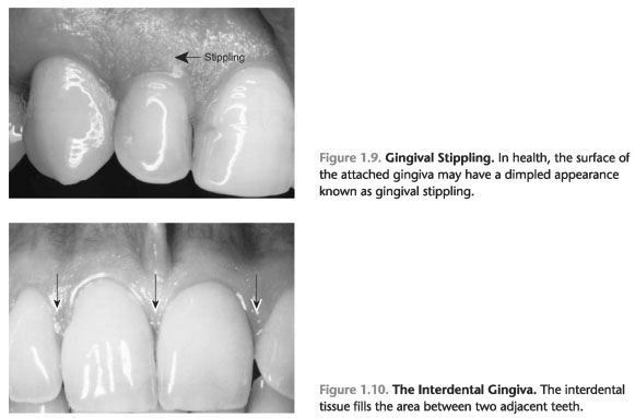 Interdental Gingiva