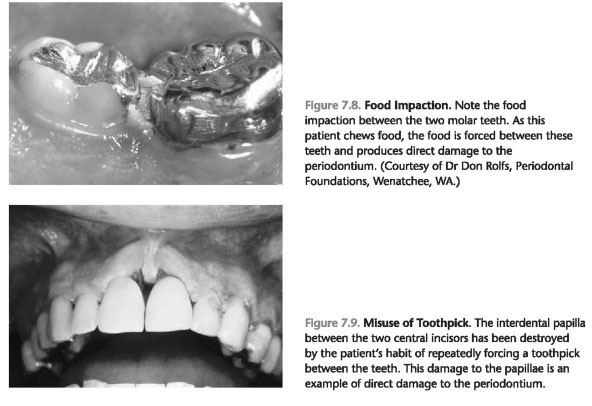 Risk factors periodontitis